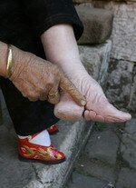 Bound feet of Chinese lady Bound feet of Chinese lady