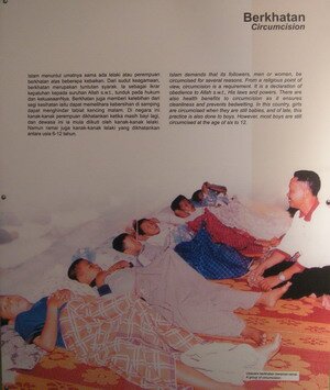 Circumcision, an important ritual for a Muslim Circumcision, an important ritual for a Muslim